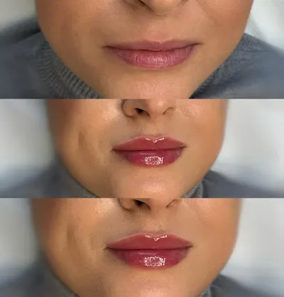 ESTESKIN CLINIC - Medycyna Estetyczna Wrocław